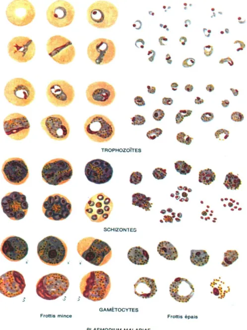 Figure 7 : Aspects morphologiques de P.malariae [4] 