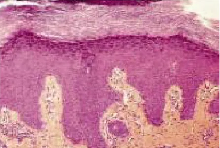 Figure 2 : Vue d’ensemble de l’épiderme visualisant bien la couche granuleuse  (hématoxyline-éosine safran, ×25)