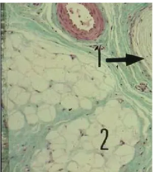 Figure 4 : coupe transversale montrant deux lobules graisseux   (numéro 2) [6] 
