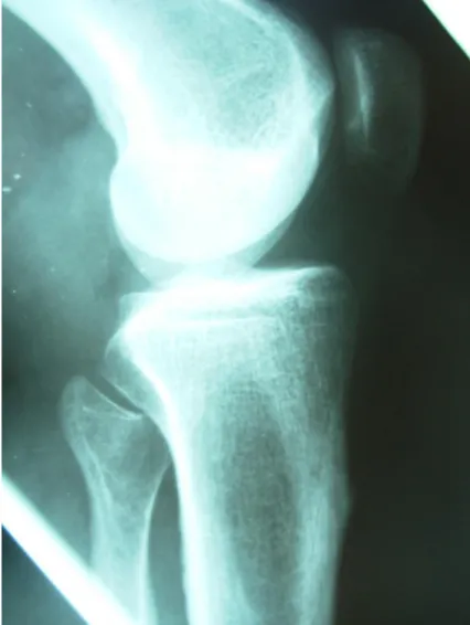 Figure 6 : Rx standard normale 