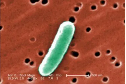 fig 3 : Gram négatif Escherichia coli.