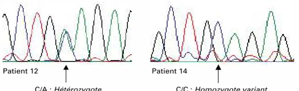 Figure 4: Électrophorégramme du séquençage d’un sujet hétérozygote C/A (double pic) et d’un  sujet homozygote C/C (pic unique) pour le polymorphisme étudié 