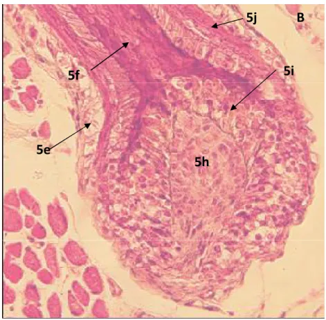 Figure 1. Coupe de paupière en paraffi  B. Coloration par hématéine-éosine. en 5e : la  gaine épithéliale externe, en 5f : la racine pilaire ; encadré, en 5g : le bulbe  pileux, en 5h : la papille folliculaire, en 5 i : des cellules matricielles, en 5 j : 