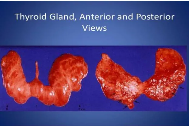 Figure 5 : vues antérieure et postérieure de la glande thyroïde.    