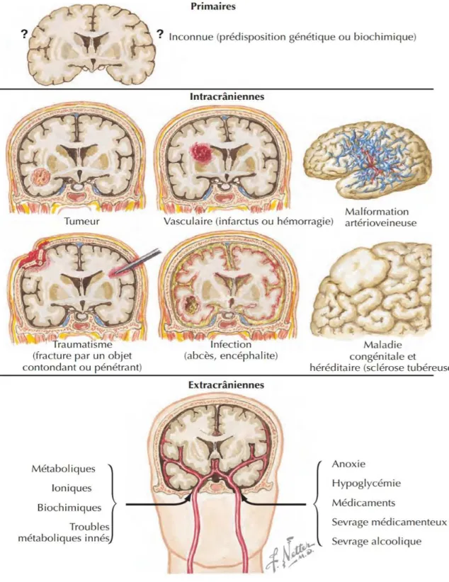 Figure 7 : étiologies de l’épilepsie  [49]