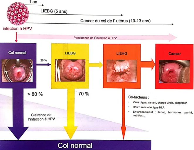 Figure 5 : Histoire naturelle de l’infection à HPV[21] 