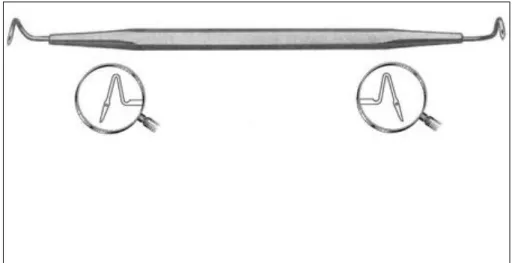 Fig. 13 : La sonde en queue de cochon 