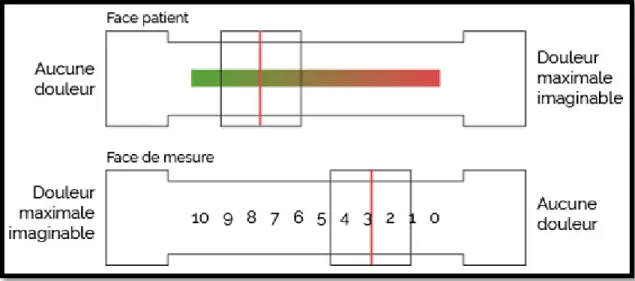 Figure 2 : Réglette de l’échelle visuelle analogique. 