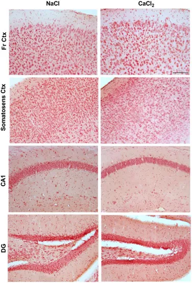 Figure  S3.  Effect  of  carotid  calcification  on  cerebral  microhemorrages.  Microhemorrages  were examined with the Prussian blue reaction at 3 weeks post-surgery in brain sections from the  right  hemispheres,  in  controls  (NaCl)  and  in  mice  wi