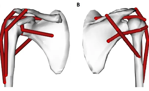 Figure 15.  Modèle de lignes d’une épaule droite – vues antérieure (A) et postérieure (B)