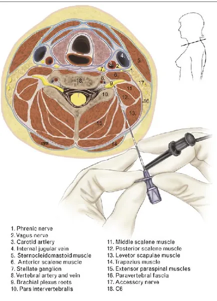 Figure 1.  Espace  paravertébral  et  les  paramètres  anatomiques  au  niveau  cervical 
