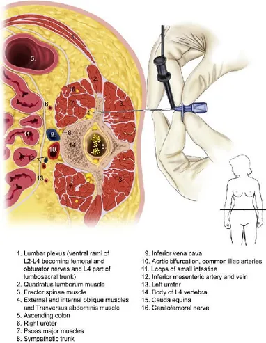 Figure 4.  L'espace paravertébral et les paramètres anatomiques au niveau  lombaire. 