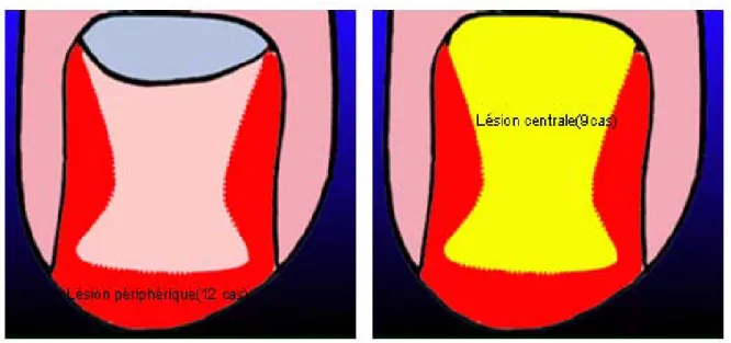 Figure 1 : Répartition des TGSU selon le siège central ou périphérique 