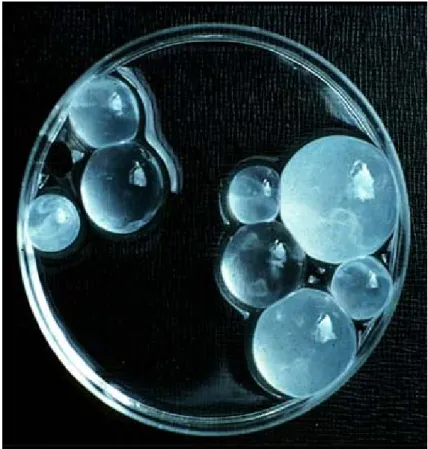 Figure 10 : Des vésicules filles détachées de la membrane proligère,  recueillies en post-opératoire (124)