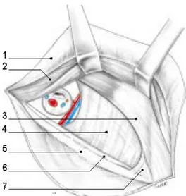 Figure 10:zone faible inguinale selon fruchaud (6) 