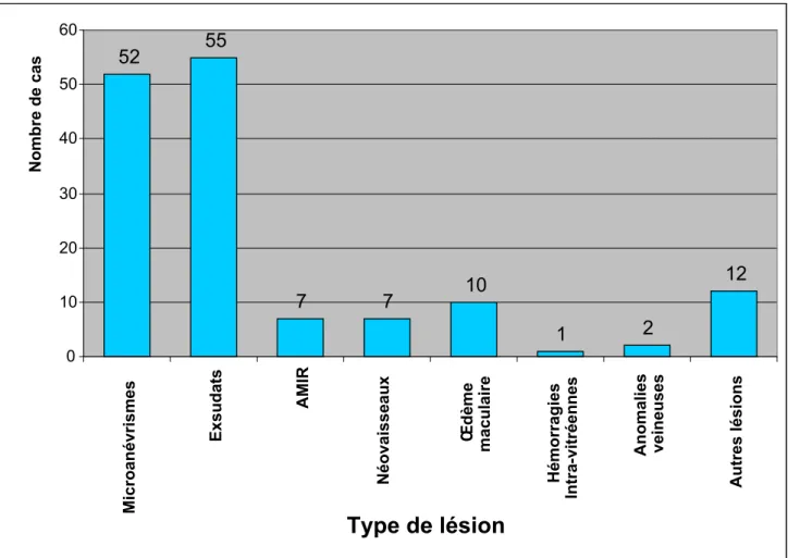 Figure 13 : Répartition des patients  