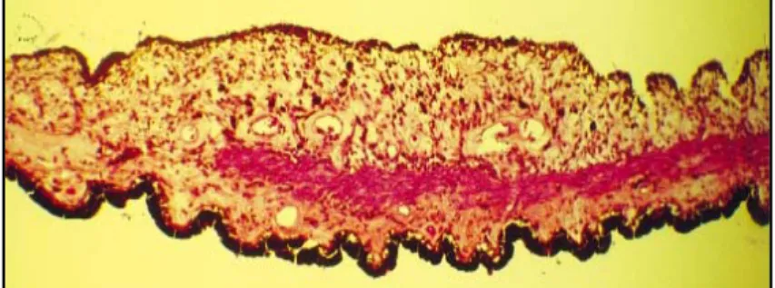 Figure A : Coupe histologique de l’iris à fort grossissement. On peut voir  l’épithélium postérieur très pigmenté, le muscle dilatateur et le stroma irien  d’arrière en avant