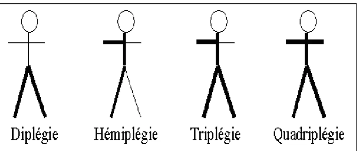 Figure 6 : Classification de l’IMC selon la  topographie 