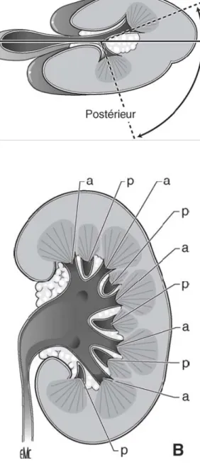 Figure 10 : Rein selon Hodson. De face, sur urographie intraveineuse,  les calices postérieurs sont en dedans, les calices antérieurs 