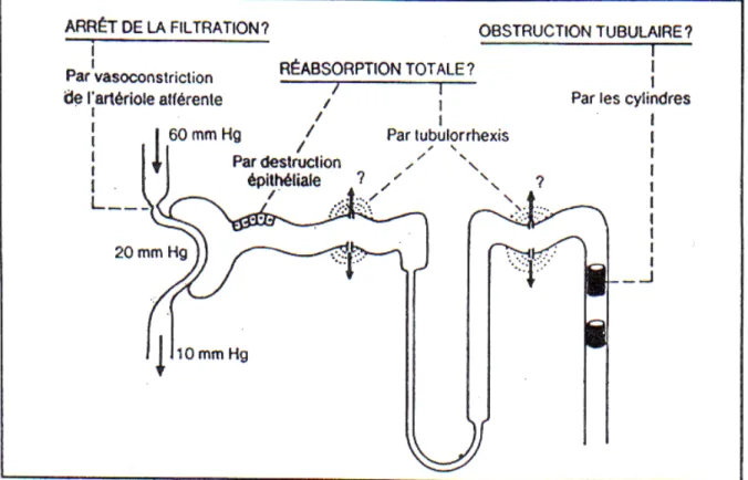 Fig 9: Différents mécanismes suggérés par l’étude des IRA expérimentales  