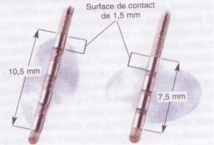 Figure 19 : Electrodes quadripolaires (modèles 3387 et 3389, Medtronic) 