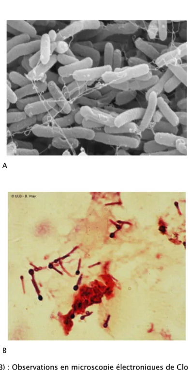 Figure 1 (A- B) : Observations en microscopie électroniques de Clostridium tétani 