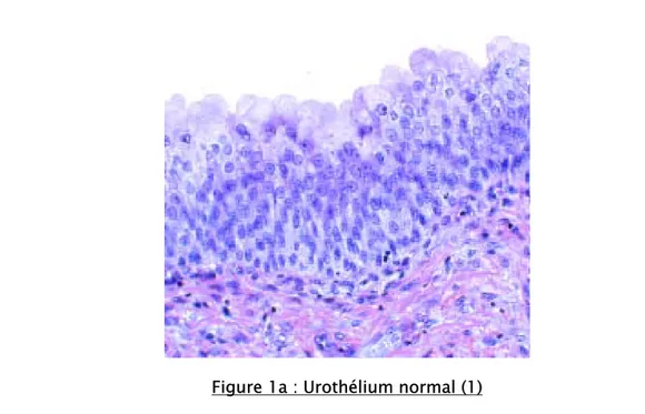 Figure 1a : Urothélium normal (1) 