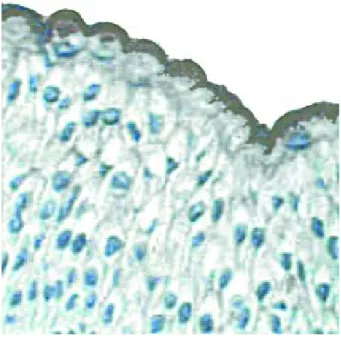 Figure 1b :Immunomarquage des cellules urothéliales   superficielles par l’anticorps anti-uroplakines (1) 