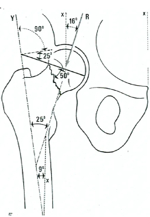Figure n°1 : Schéma de PAWELS :  X : Axe du corps 
