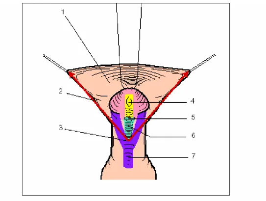 Figure 3 : Anatomie chirurgicale de l'hypospadias. 