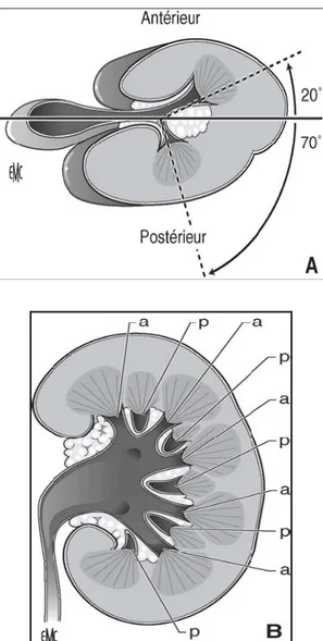 Figure 10 : Rein selon Brödel. De face, sur urographie intraveineuse, les calices postérieurs sont  en dehors 