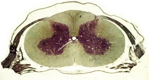 Figure 9 : photographie d’une coupe transversale de la moelle épinière. 