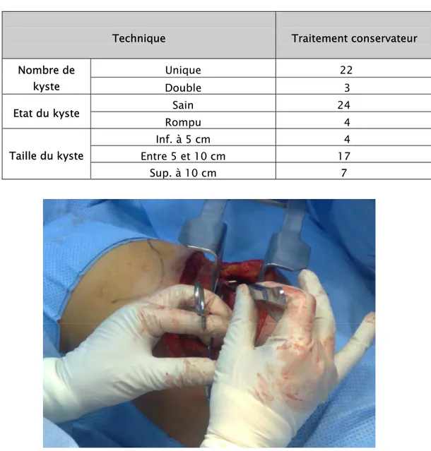 Tableau VI : Technique utilisée en fonction du nombre, de l'état et de la taille du kyste