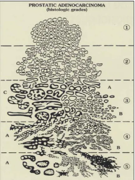 Figure 5 : Schéma dessiné par D.F Gleason (27) 