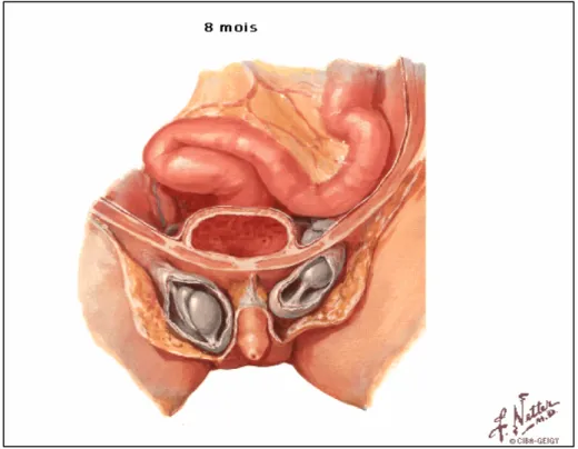 Figure 10 : Migration testiculaire trans-inguinale [6] 