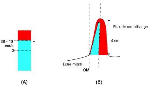 Figure 9 : Examen doppler couleur TM de la vitesse de propagation du flux mitral  (Vp)