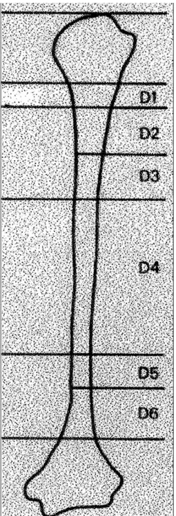 Figure n°9 [18] : Localisation des fractures selon la classification, de Hackethal modifié par De La  Caffinière 