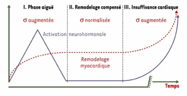 Figure 8 : schémas résumant les différents mécanismes et les étapes de l'évolution vers  L'insuffisance cardiaque après un infarctus du myocarde