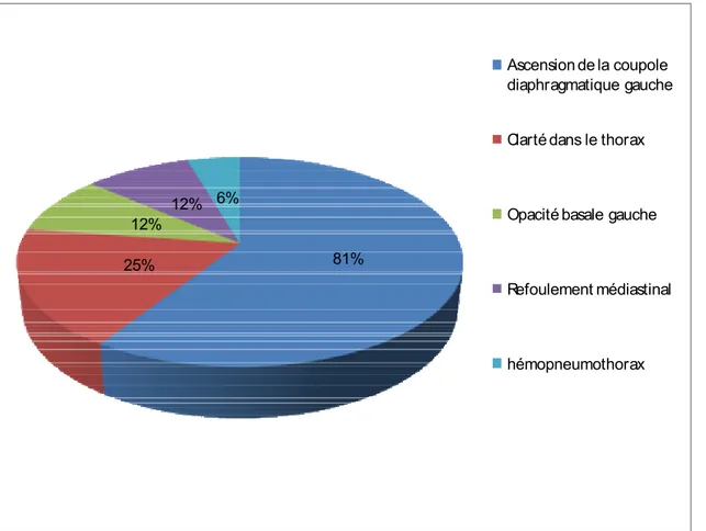 Figure 3 : signes radiologiques (radiographie thoracique) 