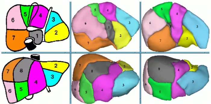 FIGURE 7 : SEGMENTATION HEPATIQUE 