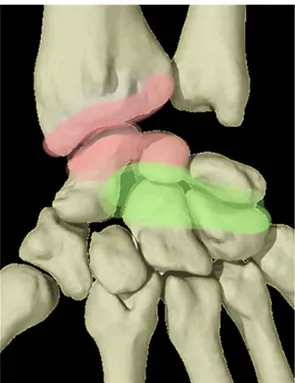 Figure 7 : Interligne RC détruit, MC intact 