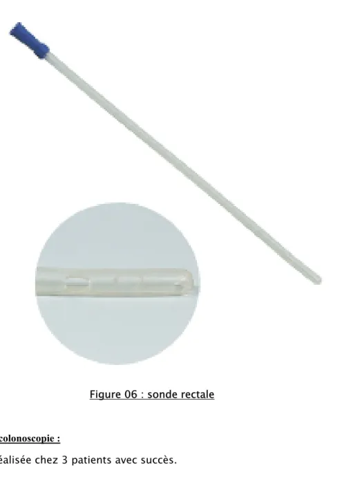 Figure 06 : sonde rectale 