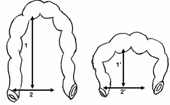 Figure 11 : Le dolichomésocôlon et le brachymésocôlon [46]. 