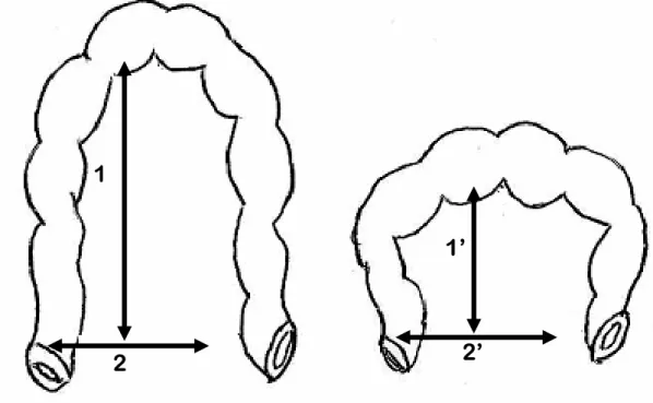 Figure 11 : Le dolichomésocôlon et le brachymésocôlon [46]. 