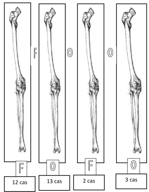 Figure 13 : association des fractures selon l’ouverture cutanée dans notre série  