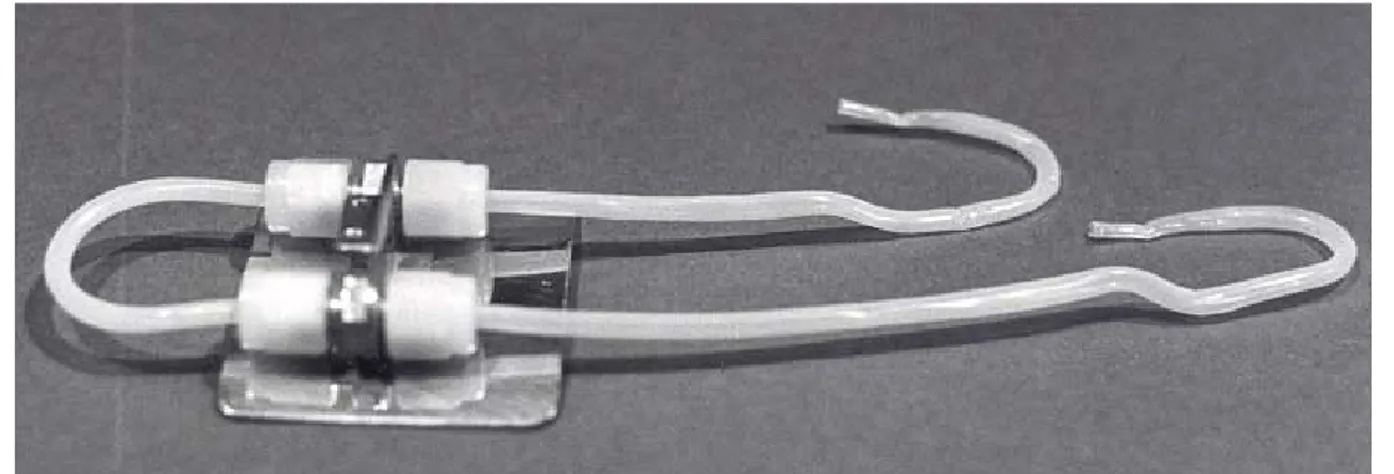 Figure 1: Le shunt artério-veineux de Scribner 