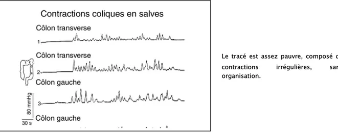 Figure 9 : Aspect de la motricité colique en dehors des contractions propagées de grande  amplitude (CPGA) [20] 