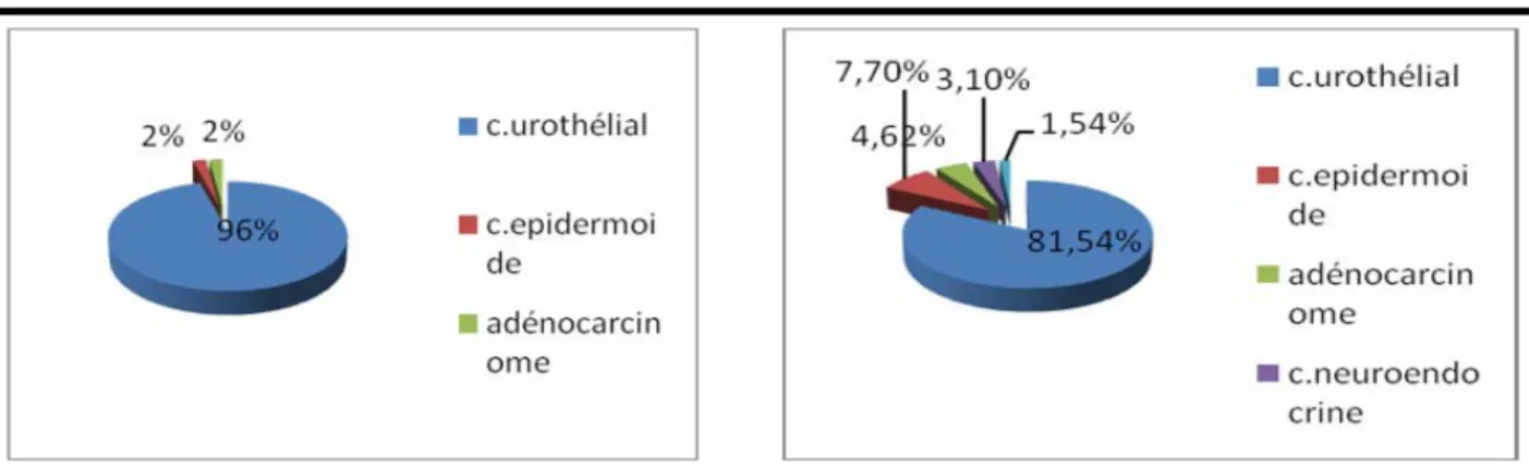 Fig 5: type histologique des sujets&lt;60 ans             Fig 6: type histologique des sujets ≥60 ans 