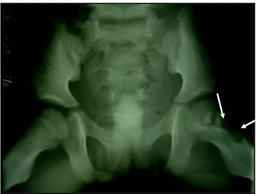 Figure N°3 : Radiographie du bassin de face  