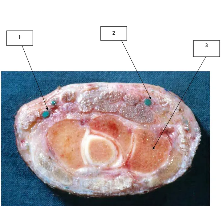 Fig    6 6 6    ::::    coupe transversale du poignet passant au niveau du canal  6 coupe transversale du poignet passant au niveau du canal  coupe transversale du poignet passant au niveau du canal  coupe transversale du poignet passant au niveau du canal